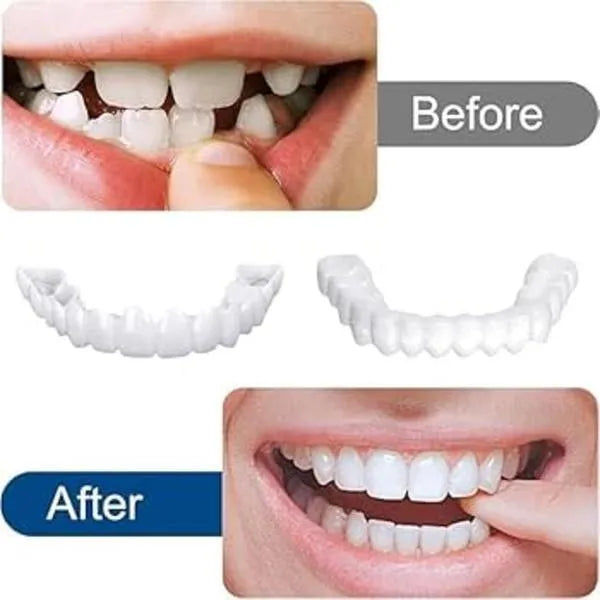 Snap On Fake Teeth Set
